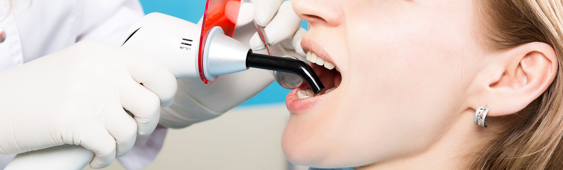 Dental Sealants/Tooth Sealants Dental Sealants for Adults & Kids