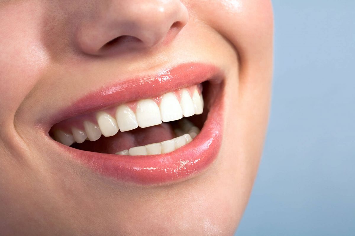 Brighten your smile with teeth whitening