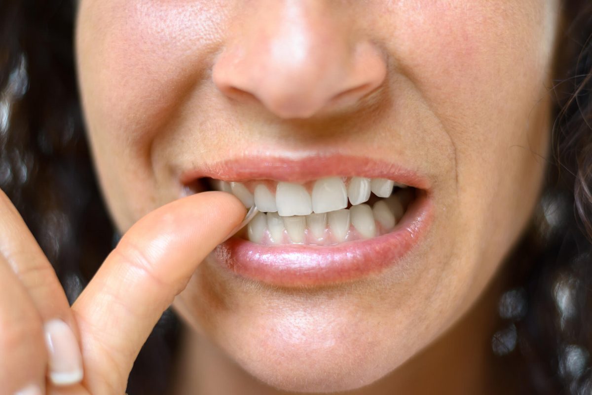 dentalt habits you need to break