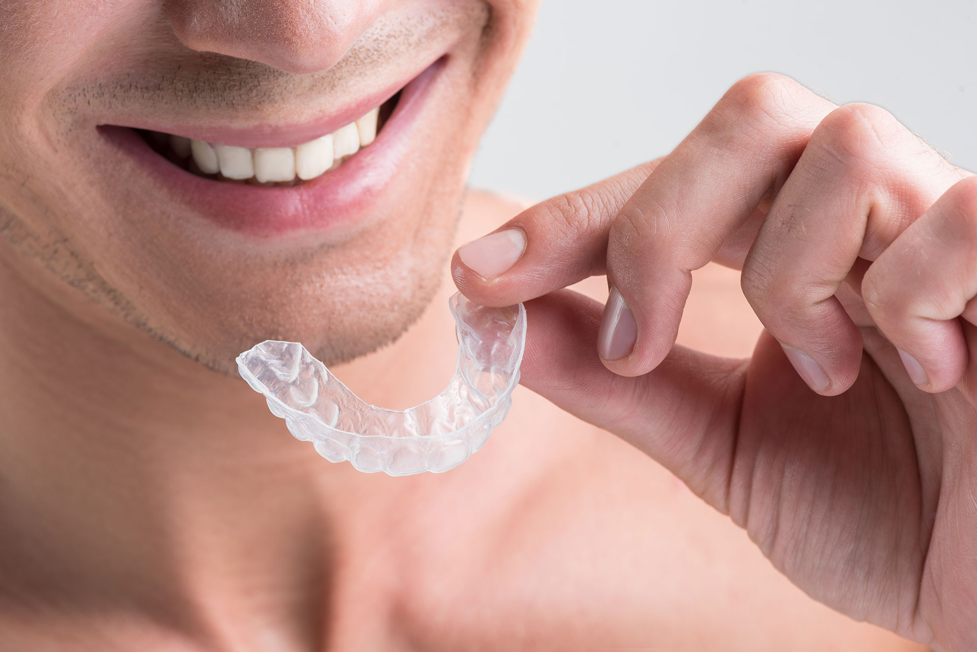 Advantages of Sure Smile