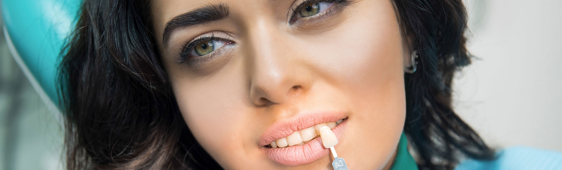 What to Expect after Porcelain Veneer Placement
