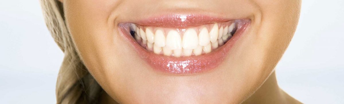 Is Gum Contouring the Treatment for You?