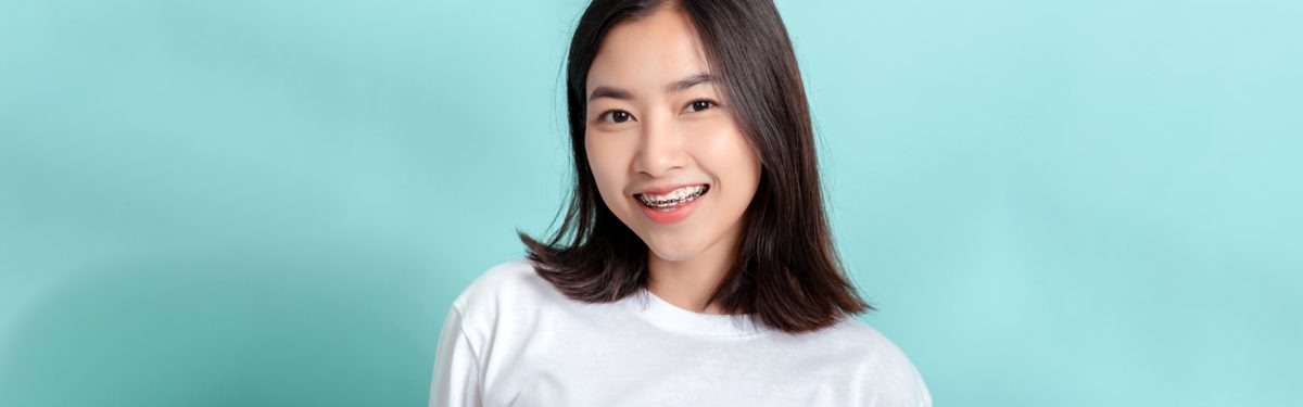 what are the advantages of clear braces 1