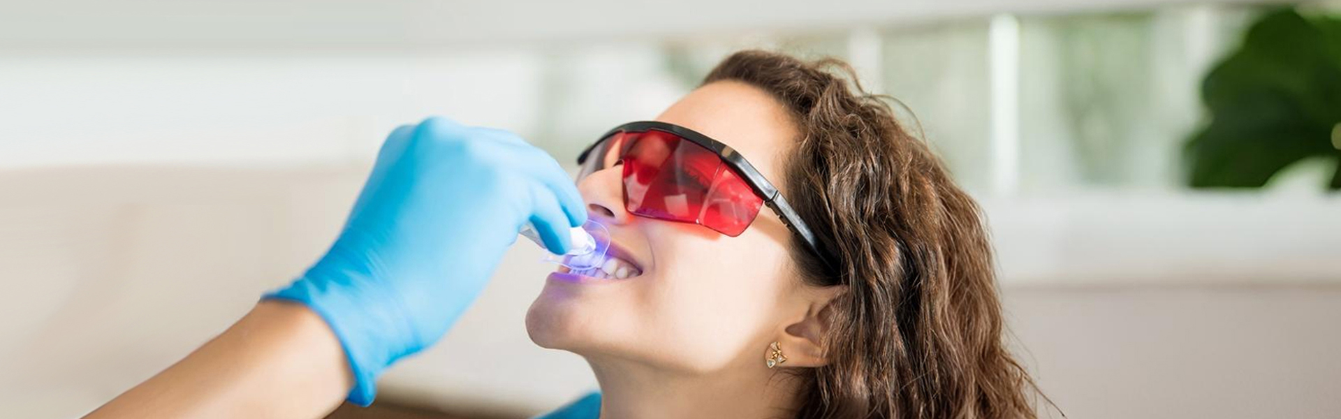 Why Teeth Whitening Is Popular in Houston, TX